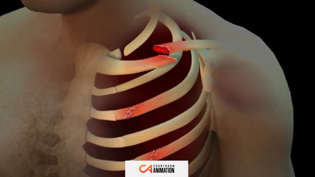 4 Reasons Why You Should Invest in 3D Medical Animation