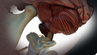 3D Medical Graphic